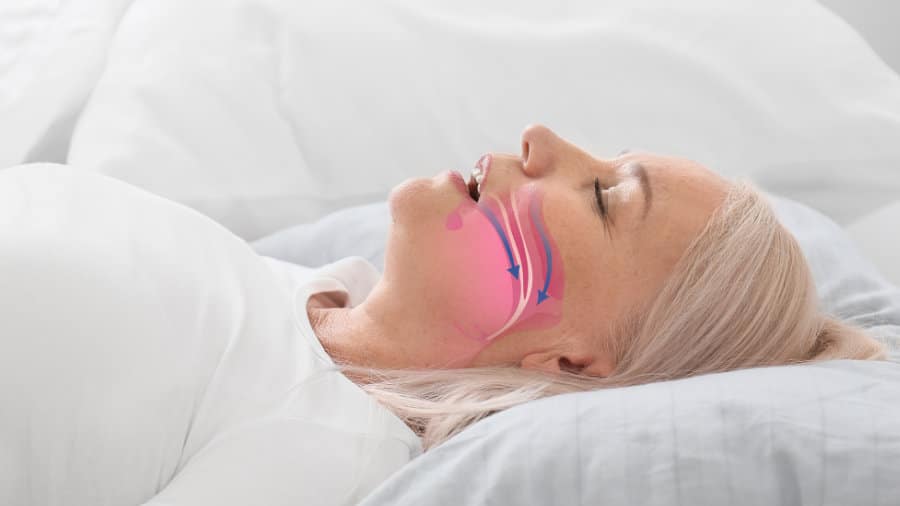 Sleep Apnea/Oral Appliance Therapy 1 sleep apnea